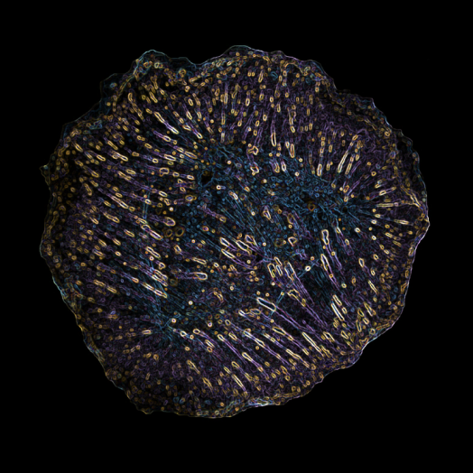 Ultrastructure of a cell generating tension - Tejeshwar Rao