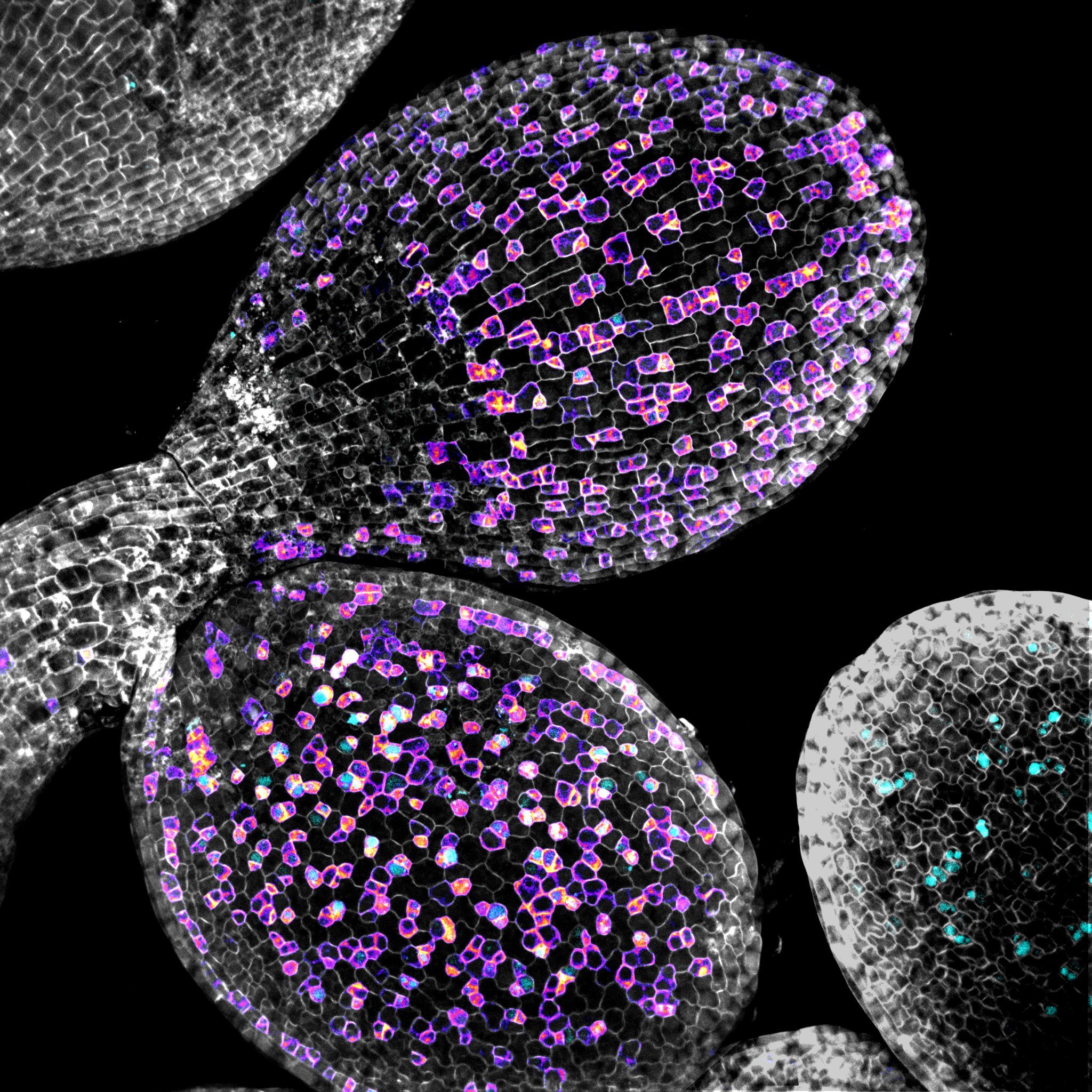 An Arabidopsis embryo epidermis being patterned - Margot Smit