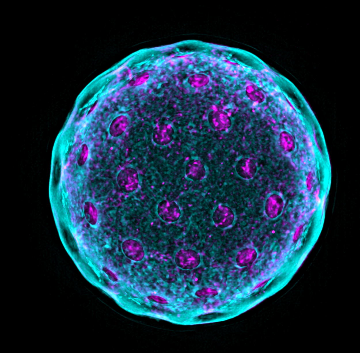 Photo of Quinoa pollen grain